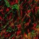Estudo desvenda comunicao entre neurnios e clulas de defesa no intestino